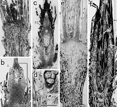 Attēlu rezultāti vaicājumam “Acaulon muticum sporophyte”