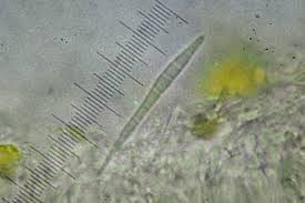 Attēlu rezultāti vaicājumam “Bacidia rubella”