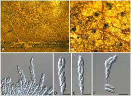 Attēlu rezultāti vaicājumam “Licea castanea spores”