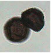 Attēlu rezultāti vaicājumam “Badhamia melanospora macro”