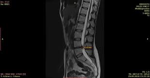 Картинки по запросу белку зажевало в диск
