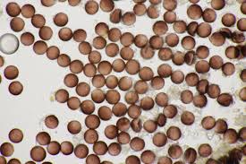 Attēlu rezultāti vaicājumam “Didymium difforme spores”