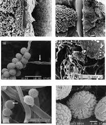 Attēlu rezultāti vaicājumam “Amaurochaete fusiformis spores”