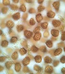 Attēlu rezultāti vaicājumam “Fossombronia foveolata spores”