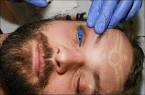 Bizarre Eyeball Tattooing! - Photo Librarian
