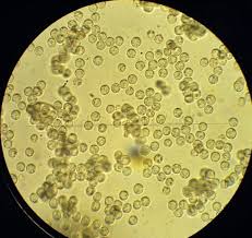Attēlu rezultāti vaicājumam “Arcyria cinerea spores”
