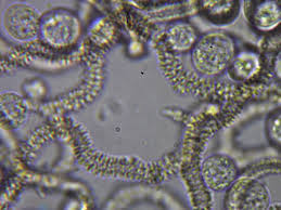 Attēlu rezultāti vaicājumam “Arcyria cinerea spores”