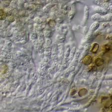 Attēlu rezultāti vaicājumam “Chaenotheca trichialis”