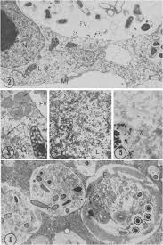 Attēlu rezultāti vaicājumam “Lignydium muscorum plasmodium”