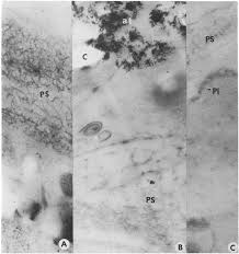 Attēlu rezultāti vaicājumam “Diderma testaceum young”