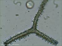 Attēlu rezultāti vaicājumam “Heterotrichia obvelata (syn. Arcyria obvelata) stalked”