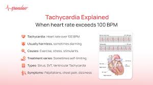 Billedresultat for BPM