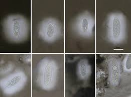 Attēlu rezultāti vaicājumam “Pertusaria leioplaca”