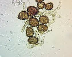 Attēlu rezultāti vaicājumam “Fossombronia foveolata sporophyte”