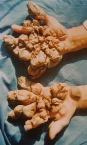 Image result for Lewandowsky-Lutz