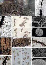 Attēlu rezultāti vaicājumam “Stemonitopsis aequalis (var. aequalis) spores”