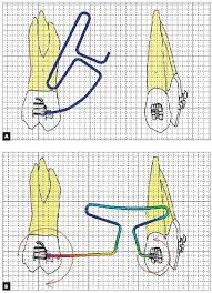Image result for the end of the t-loop structure