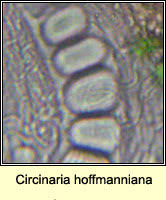 Attēlu rezultāti vaicājumam “Licea minima spores”