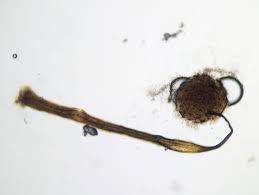 Attēlu rezultāti vaicājumam “Cribraria costata spores”