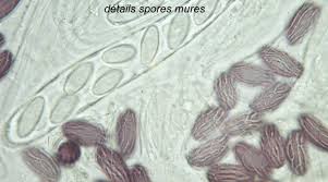 Attēlu rezultāti vaicājumam “Ascobolus furfuraceus”