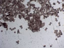 Attēlu rezultāti vaicājumam “Fuligo septica var. candida spores”