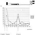 ScienceDirect.com - Pediatric Neurology - Dancing Eye <b>Syndrome</b> and