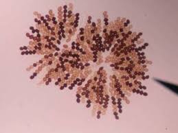 Attēlu rezultāti vaicājumam “Sordaria fimicola”