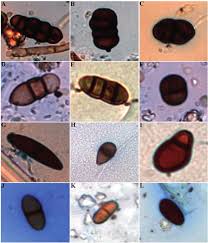 Attēlu rezultāti vaicājumam “Badhamia juliae spores”