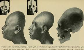 Image result for elongated skulls
