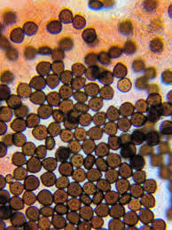 Attēlu rezultāti vaicājumam “Enteridium variabile spores”