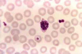 Attēlu rezultāti vaicājumam “Colloderma oculatum plasmodium”