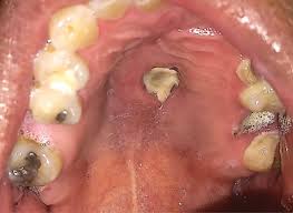 2009/03/post-c2ad.html에 대한 이미지 검색결과