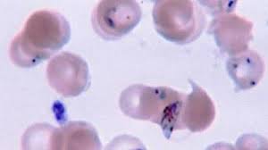 Attēlu rezultāti vaicājumam “Diderma cingulatum plasmodium”