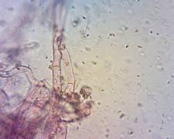 Attēlu rezultāti vaicājumam “Ceriporia excelsa”