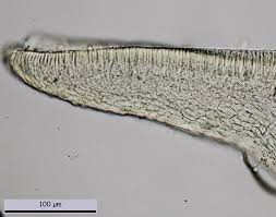 Attēlu rezultāti vaicājumam “Hyalorbilia inflatula”