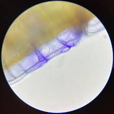 Attēlu rezultāti vaicājumam “Sphagnum papillosum”
