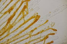 Attēlu rezultāti vaicājumam “Byssonectria fusispora”