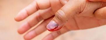 Znalezione obrazy dla zapytania palec