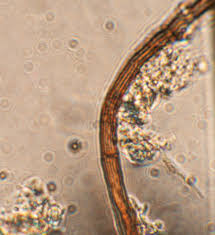 Attēlu rezultāti vaicājumam “Trichia botrytis spores”