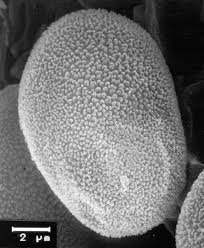 Attēlu rezultāti vaicājumam “Perichaena depressa sessile”