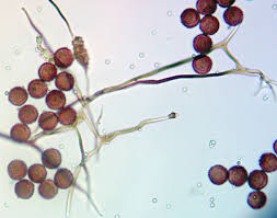 Attēlu rezultāti vaicājumam “Diderma subviridifuscum”