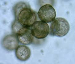Attēlu rezultāti vaicājumam “Didymium sp.”
