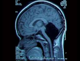 Image result for no brain