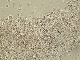 Attēlu rezultāti vaicājumam “Corticium roseum”