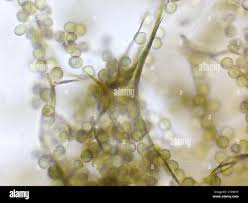 Attēlu rezultāti vaicājumam “Reticularia jurana macro”