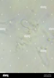 Attēlu rezultāti vaicājumam “Trechispora mollusca”