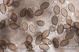 Attēlu rezultāti vaicājumam “Melanospora lagenaria”