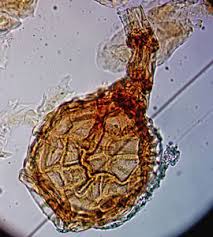 Attēlu rezultāti vaicājumam “Milesina murariae”