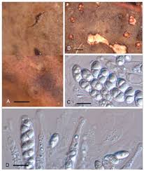 Attēlu rezultāti vaicājumam “Licea castanea spores”