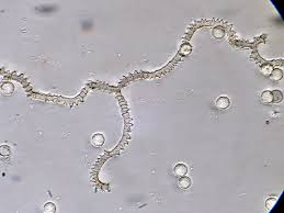 Attēlu rezultāti vaicājumam “Arcyria denudata”